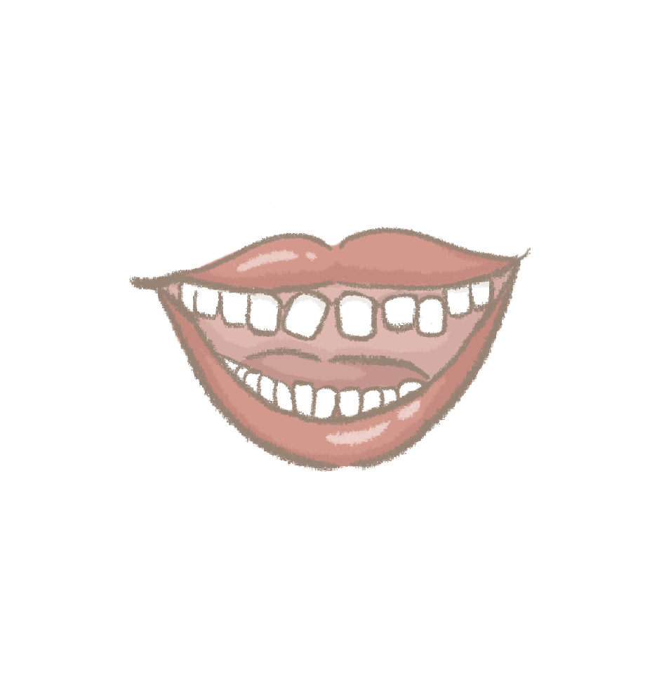 牙齒病理性位移
