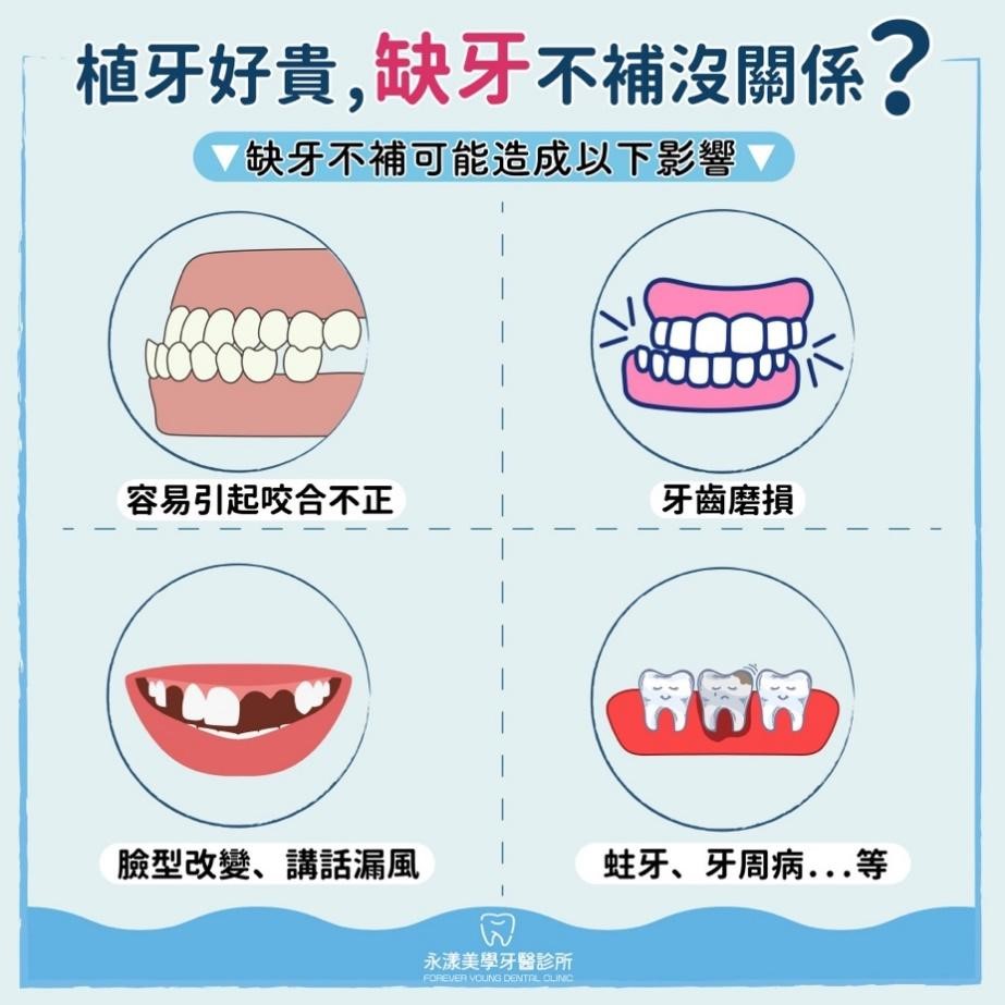長期缺牙的影響